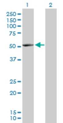 Western Blot: NARS2 Antibody [H00079731-B01P]