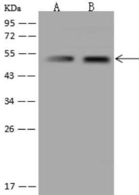 Western Blot: NARS2 Antibody [NBP3-06406]