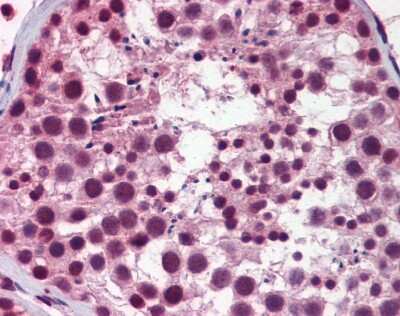 Immunohistochemistry-Paraffin: NASP Antibody [NBP1-52914]