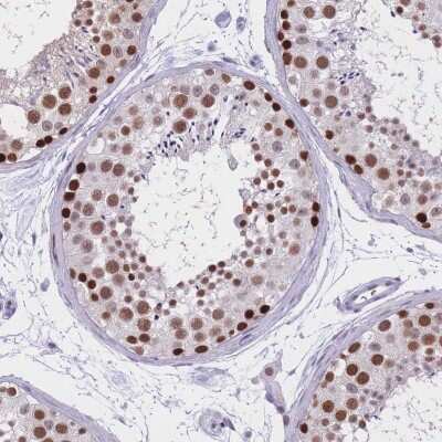 Immunohistochemistry-Paraffin: NASP Antibody [NBP2-33928]