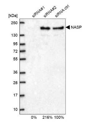 Western Blot: NASP Antibody [NBP2-33929]