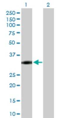 Western Blot: NAT1 Antibody [H00000009-D01P]