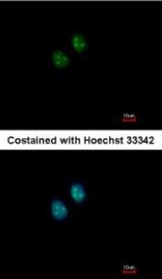 Immunocytochemistry/ Immunofluorescence: NAT10 Antibody [NBP2-15034]