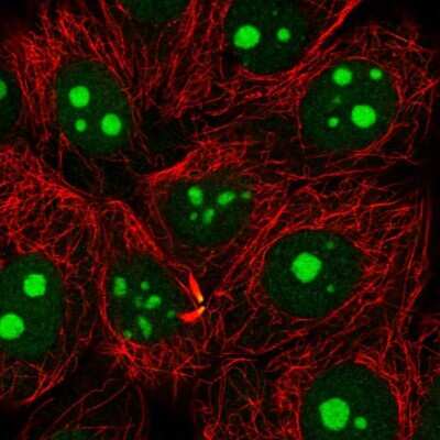 Immunocytochemistry/ Immunofluorescence: NAT10 Antibody [NBP2-56861]