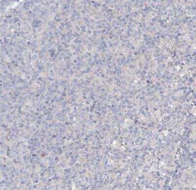 Immunohistochemistry-Paraffin: NAT11 Antibody [NBP1-92168]