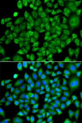 Immunocytochemistry/ Immunofluorescence: NAT13 Antibody - BSA Free [NBP2-93356]