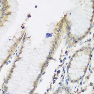 Immunohistochemistry-Paraffin: NAT13 Antibody - BSA Free [NBP2-93356]