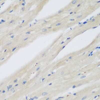 Immunohistochemistry-Paraffin: NAT13 Antibody - BSA Free [NBP2-93356]