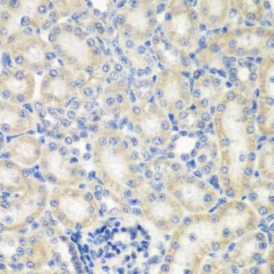 Immunohistochemistry-Paraffin: NAT13 Antibody - BSA Free [NBP2-93356]
