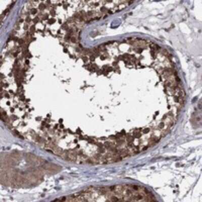 Immunohistochemistry-Paraffin: NAT13 Antibody [NBP3-17743]