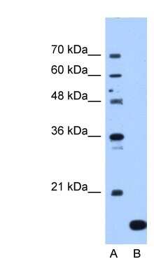 Western Blot: NAT13 Antibody [NBP1-55172]