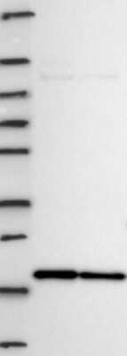 Western Blot: NAT13 Antibody [NBP3-17743]