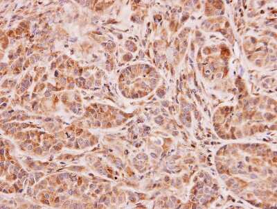 Immunohistochemistry-Paraffin: NAT2 Antibody [NBP1-33751]