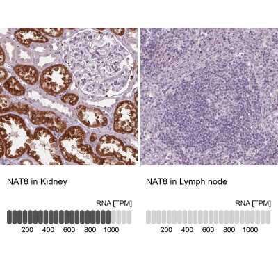 Immunohistochemistry-Paraffin: NAT8 Antibody [NBP2-62657]