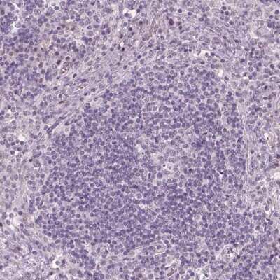 Immunohistochemistry-Paraffin: NAT8 Antibody [NBP2-62657]