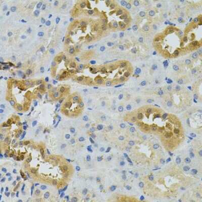 Immunohistochemistry-Paraffin: NAT8 Antibody - BSA Free [NBP2-93546]