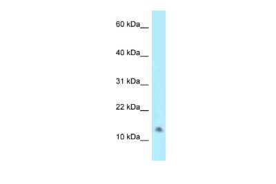 Western Blot: NAT8L Antibody [NBP2-85358]