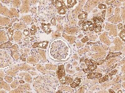 Immunohistochemistry: NAV1 Antibody [NBP3-06303]