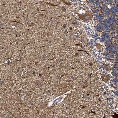Immunohistochemistry-Paraffin: NAV1 Antibody [NBP1-84083]