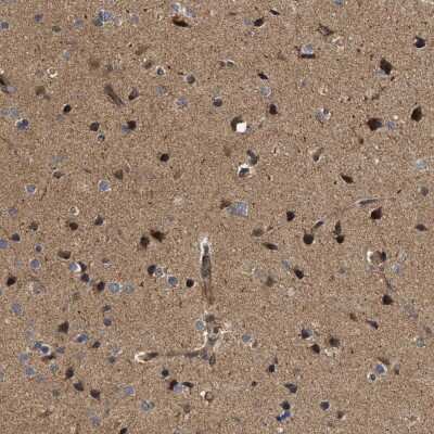 Immunohistochemistry-Paraffin: NAV1 Antibody [NBP1-84083]