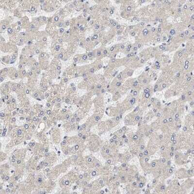 Immunohistochemistry-Paraffin: NAV1 Antibody [NBP1-84083]