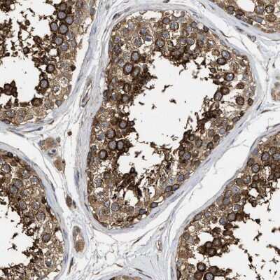 Immunohistochemistry-Paraffin: NAV1 Antibody [NBP1-84083]