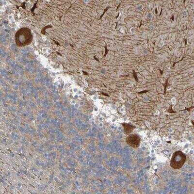 Immunohistochemistry-Paraffin: NAV2 Antibody [NBP1-84615]