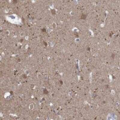 Immunohistochemistry-Paraffin: NAV3 Antibody [NBP3-17520]