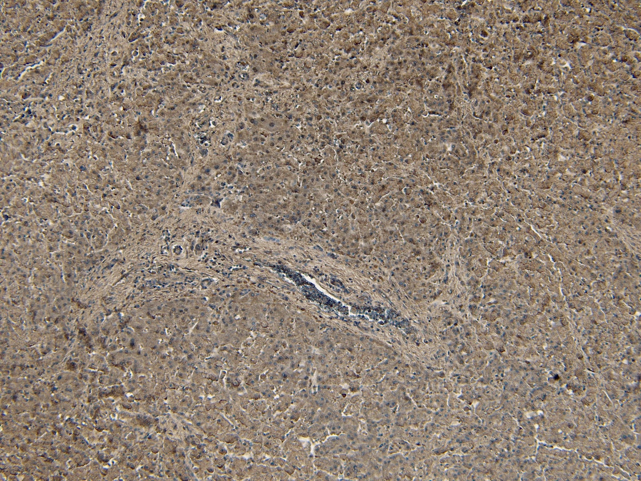 Immunohistochemistry-Paraffin: Proprotein Convertase 9/PCSK9 Antibody [NB300-959]