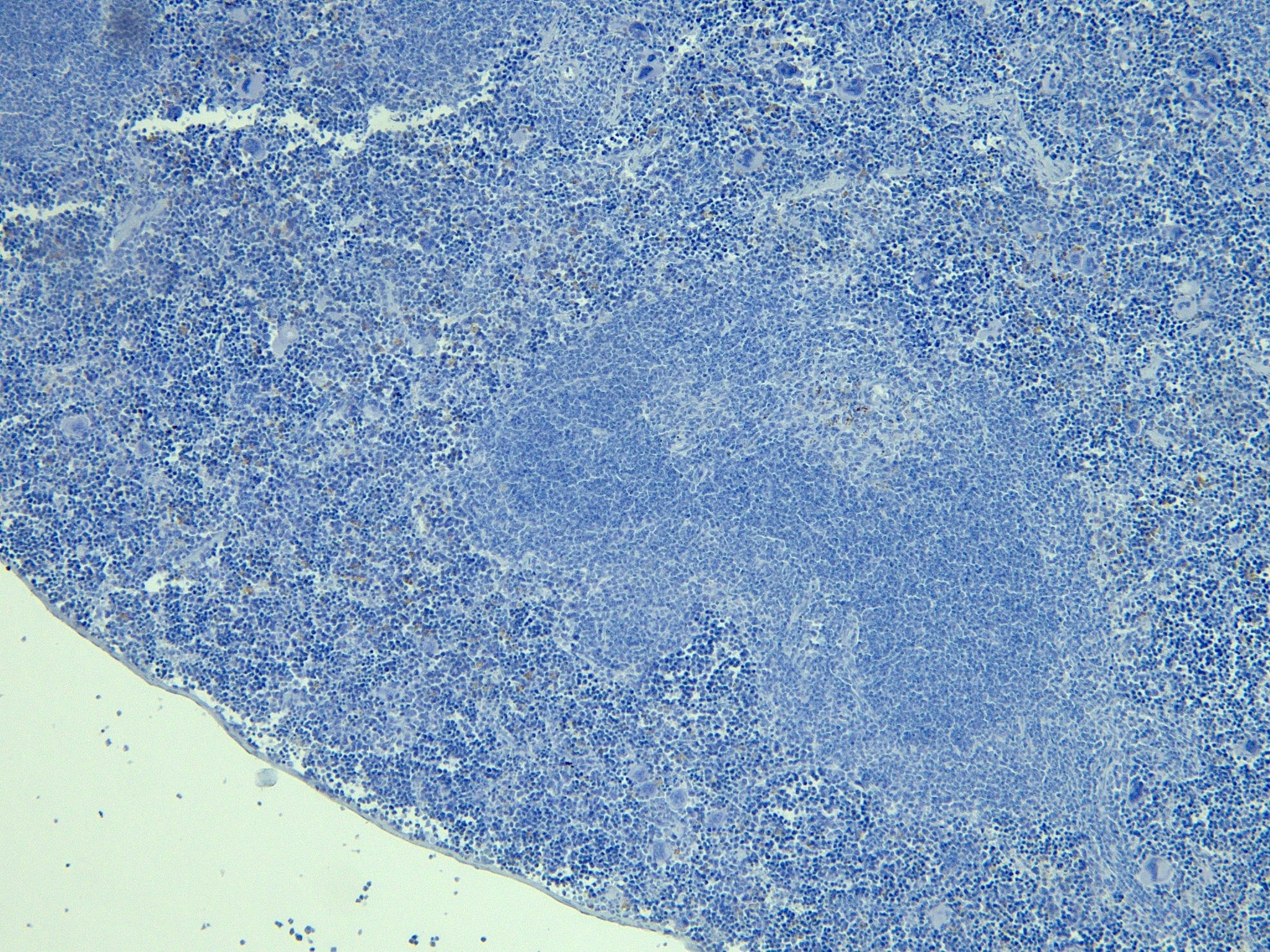 Immunohistochemistry-Paraffin: FoxP3 Antibody [NB600-243]
