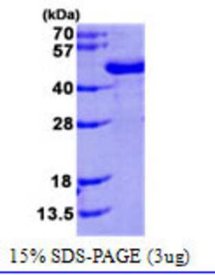 Western Blot: Recombinant Human FUS2 His Protein [NBC1-21281]