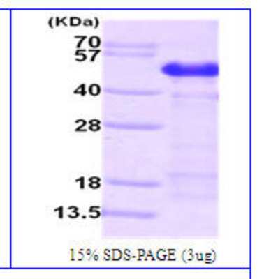 Western Blot: Recombinant Human Calumenin His Protein [NBC1-26372]