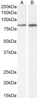 Western Blot: PLC-delta 3 Antibody [NBP3-20228]