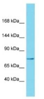 Western Blot: NBPF15 Antibody [NBP3-09717]