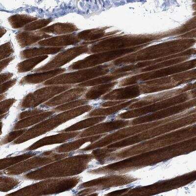 Immunohistochemistry: NBR1 Antibody [NBP1-89399]