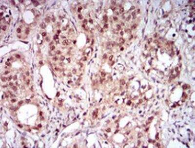 Immunohistochemistry-Paraffin: Nbs1 Antibody (7E4A2) [NBP2-26297]