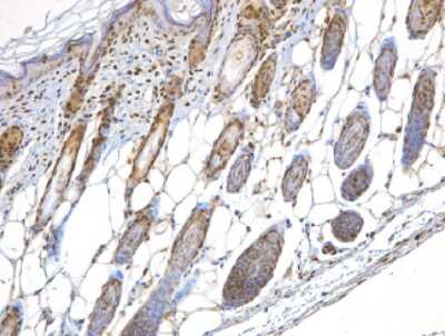 Immunohistochemistry-Paraffin: Nbs1 Antibody - BSA Free [NBP1-06705]