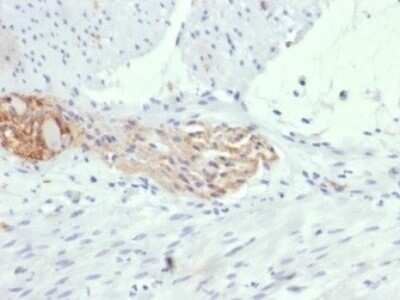 Immunohistochemistry-Paraffin: NCAM-1/CD56 Antibody (123A8 (same as 56C04)) - Azide and BSA Free [NBP2-34518]