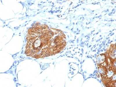 Immunohistochemistry-Paraffin: NCAM-1/CD56 Antibody (123A8 (same as 56C04)) - IHC-Prediluted [NBP2-44713]