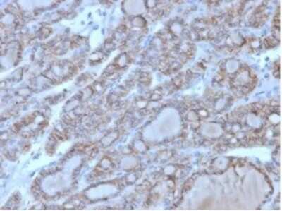 Immunohistochemistry-Paraffin: NCAM-1/CD56 Antibody (123A8 (same as 56C04)) - IHC-Prediluted [NBP2-44713]