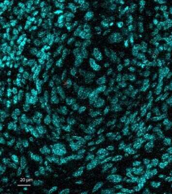 Immunohistochemistry: NCAM-1/CD56 Antibody (123A8 (same as 56C04)) [NBP2-34279]