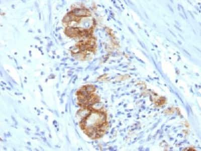 Immunohistochemistry-Paraffin: NCAM-1/CD56 Antibody (123C3.D5) - Azide and BSA Free [NBP2-33132]