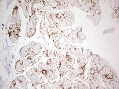 Immunohistochemistry: NCAM-1/CD56 Antibody (OTI1B9) [NBP2-46107]