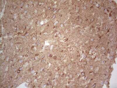 Immunohistochemistry: NCAM-1/CD56 Antibody (OTI1B9) [NBP2-46107]