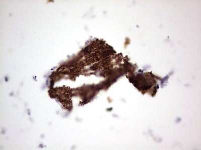 Immunohistochemistry: NCAM-1/CD56 Antibody (OTI1B9) [NBP2-46107]