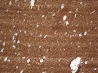 Immunohistochemistry: NCAM-1/CD56 Antibody (OTI1B9) [NBP2-46107]