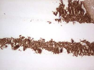 Immunohistochemistry: NCAM-1/CD56 Antibody (OTI1B9) [NBP2-46107]
