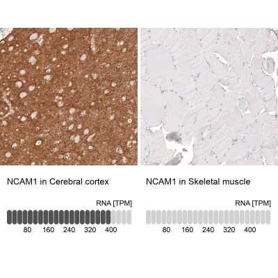 Immunohistochemistry-Paraffin: NCAM-1/CD56 Antibody (CL12732) [NBP3-18543]
