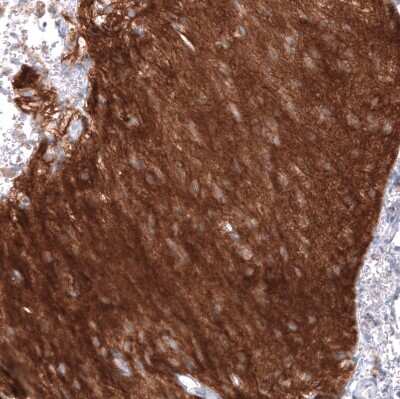 Immunohistochemistry-Paraffin: NCAM-1/CD56 Antibody (CL12732) [NBP3-18543]