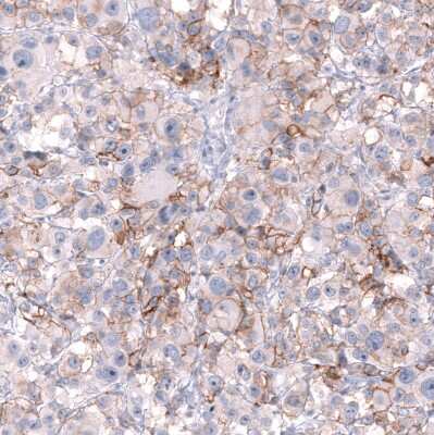 Immunohistochemistry-Paraffin: NCAM-1/CD56 Antibody (CL12732) [NBP3-18543]